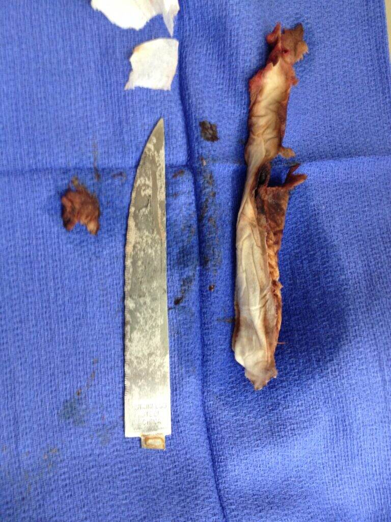 The wrapping that allowed the knife to be swallowed—still not that easy!